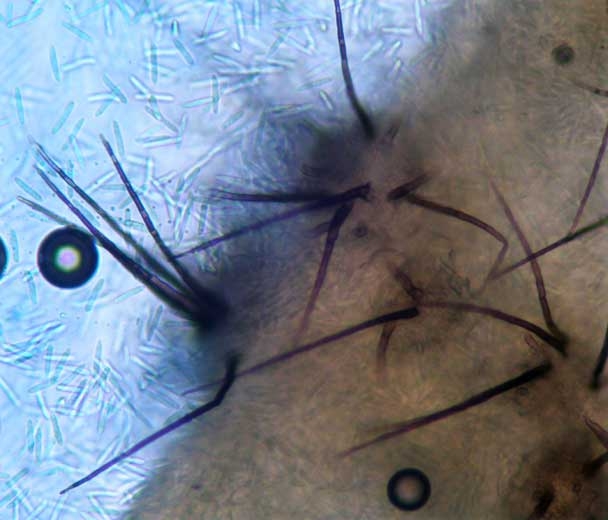 Observation under a light microscope makes it possible to better distinguish the acervuli.  They all have several brown, septate bristles, and the spores are clumped together in the form of mucus.
 <i> <b> Colletotrichum orbiculare </b> </i> (anthracnose)