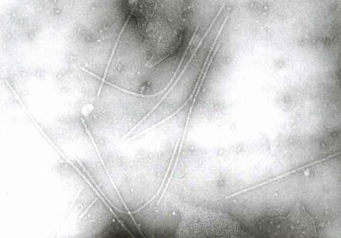 Flexuous viral particles of potato virus Y (PVY) are of 705 to 759 nm long and 12 nm in diameter.
