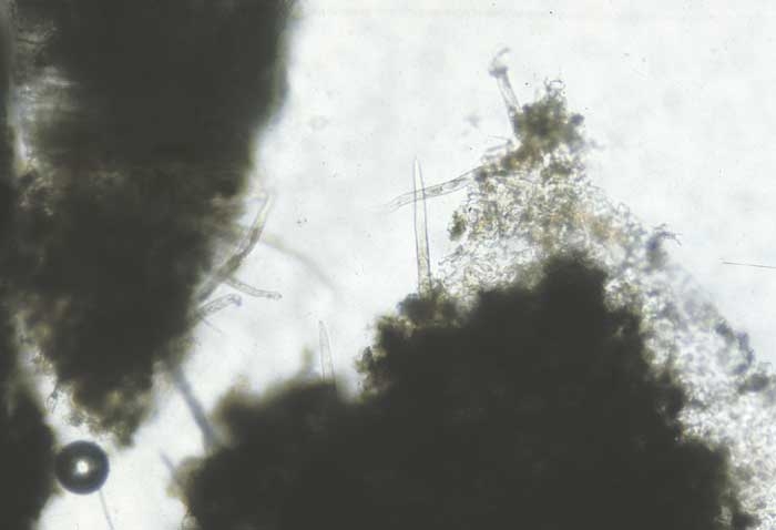 When dissecting  damaged tissues, one can observe several foliar nematodes. <i><b>Aphelenchoides ritzemabosi</b></i> (checkered leaf disease)
