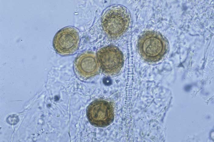 Brown oospores can be observed in altered tissues, they ensure the sexual reproduction of the fungus. <b><i>Peronospora hyoscyami</i> f. sp. <i>tabacina</i></b> (tobacco blue mould, downy mildew)

