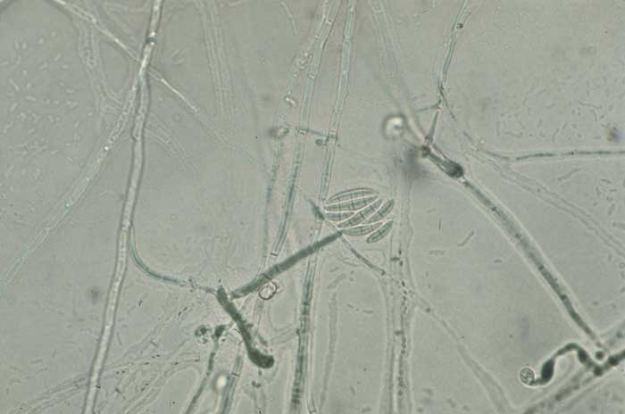 <b><i>Fusarium oxysporum </i>f. sp. <i>nicotianae</i> </b> (fusarium wilt) produces on short conidiophores, curved, elongated multicellular macroconidia. It is also produces unicellular microconidia and chlamydospores.

