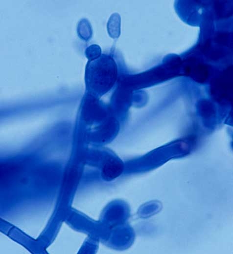 A few basidia, often with 4 basidiospores may be observed on the white hymenium which partly covers the infected plant organs and the soil. <b><i>Thanatephorus cucumeris</i></b>

