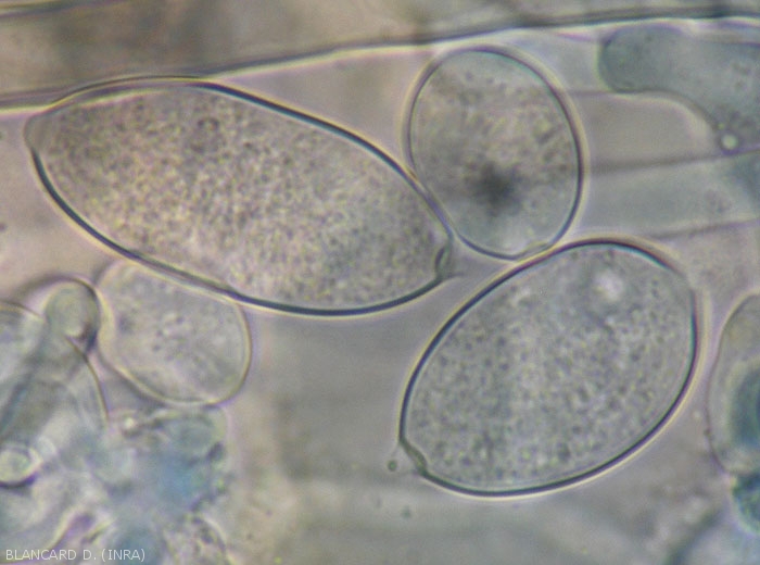Morphological variability of sporangia of <b><i>Phytophthora infestans</i></b> observed under a light microscope.  (mildew)