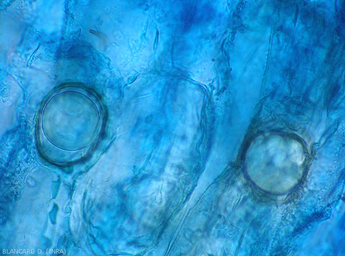 Appearance of oospores of <b><i>Phytophthora</i> sp.</b> observed under a light microscope.  (Oomycetes)