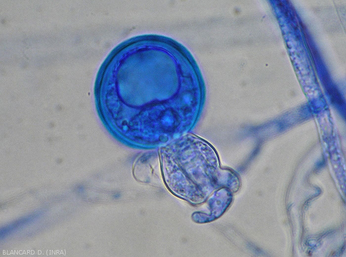 Appearance of a fertilized oogonia of <i>Phytophthora infestans</i>.  (mildew).