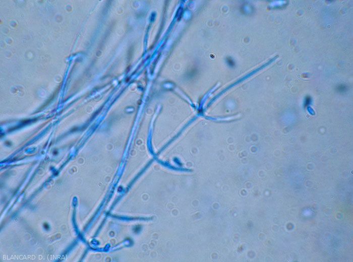 Verticillium-Conidiophores