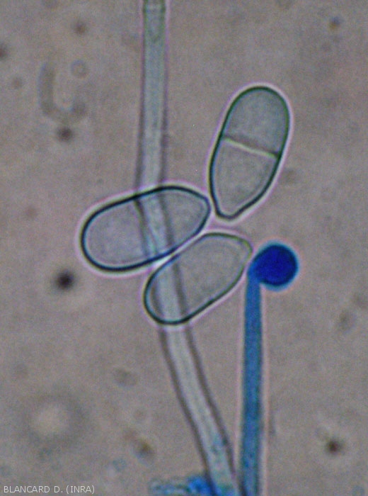 Appearance of some hyaline and bicellular conidia located near the end of a <i> <b> Trichothecium roseum </b> </i> conidiophore.  (pink mold)