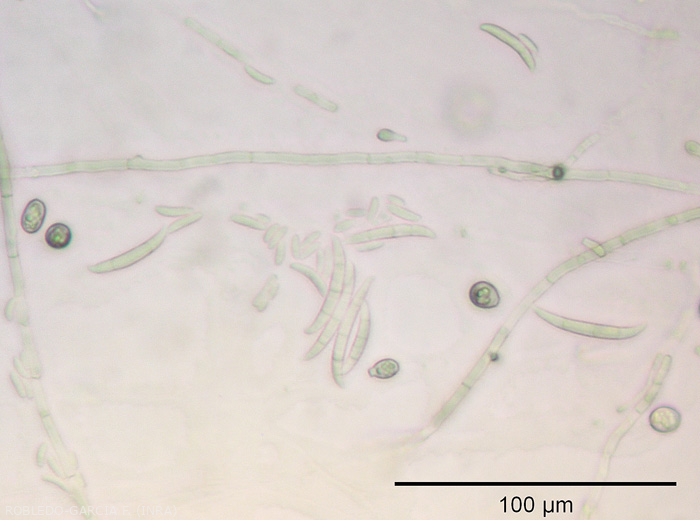 <b><i> Fusarium oxysporum </i> f.  sp.  <i> melongenae </i></b> forms macro- and microconidia, as well as chlamydospores that ensure its dissemination and preservation. 