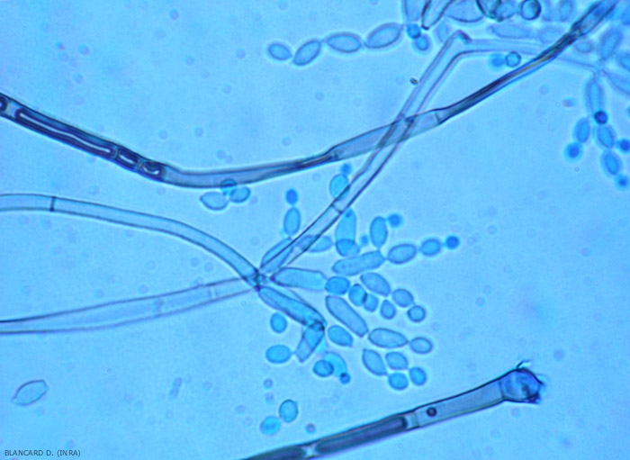 This sympodial growing <b> <i> Cladosporium </i> sp. </b> conidiophore bears ovoid to elongated conidia.