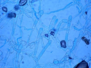 <i><b>Podosphaera fuliginea</b></i> (<i>Sphaerotheca fuliginea</i>) et <b><i>Golovinomyces cichoracearum</i> var. <i>cichoracearum</i></b> (<i>Erysiphe cichoracearum</i>) (oïdium ou "blanc", powdery mildew, white mold) on zucchini 15