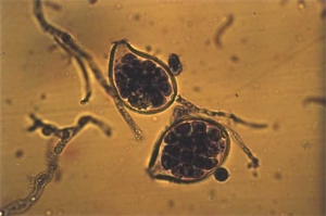 Two papillate sporangia filled with mobile zoospores. <i><b>Phytophthora nicotianae </b></i>(black shank), a heterothallic chromist, produces also spherical chlamydospores and thick-walled oospores. 
