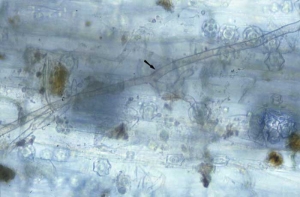 Brown and ramified mycelium of <i><b>Rhizoctonia solani</b></i> is easily observed on this root system.
