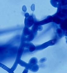 A few basidia, often with 4 basidiospores may be observed on the white hymenium which partly covers the infected plant organs and the soil. <b><i>Thanatephorus cucumeris</i></b>

