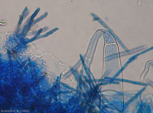 Several conidiophores emerging from a stomata and conidia are present on this leaf portion observed under a light microscope.
 <i>Pseudocercospora fuligena</i> (cercospora leaf spot)