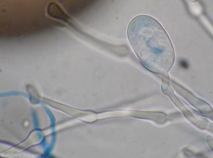 Formation of a young sporangium, note the swellings present on the sporangiophores.  <b><i>Phytophthora infestans</i></b> (downy mildew)