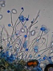 Several young sporangiophores with swellings are developing.  (<i>Phytophthora infestans</i>) (downy mildew)