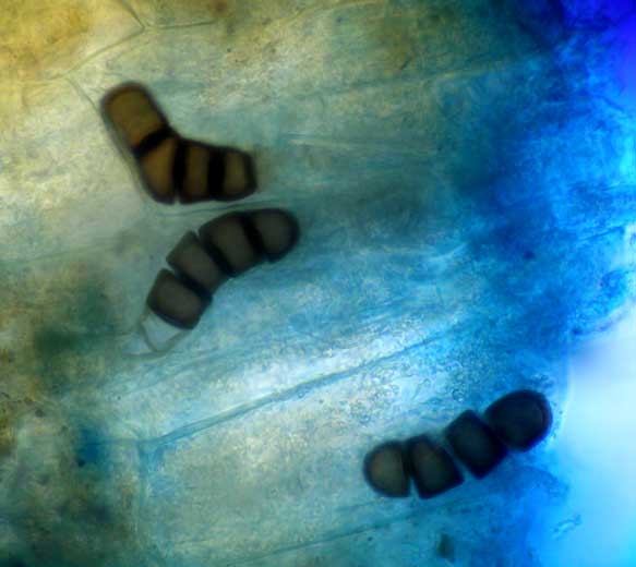 <b> <i> Thielaviopsis basicola </i> </b> (ex <i> Chalara elegans </i>, pudrición de la raíz negra) sobre berenjena.