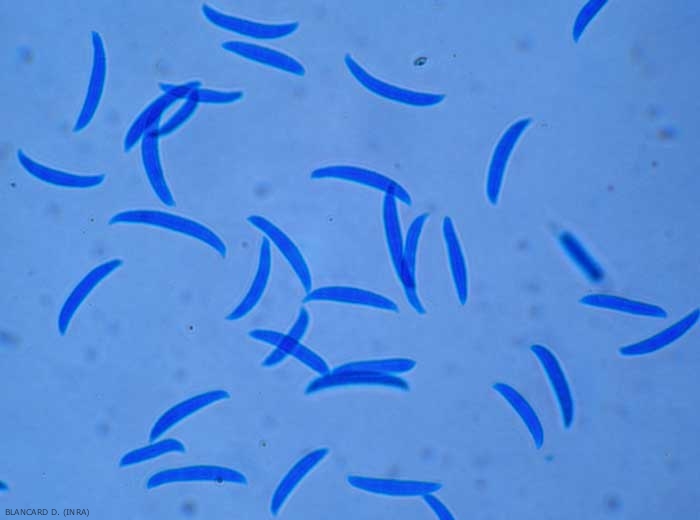 Aspecto de algunos macroconidios de <b> <i> Fusarium </i> sp.  </b> 