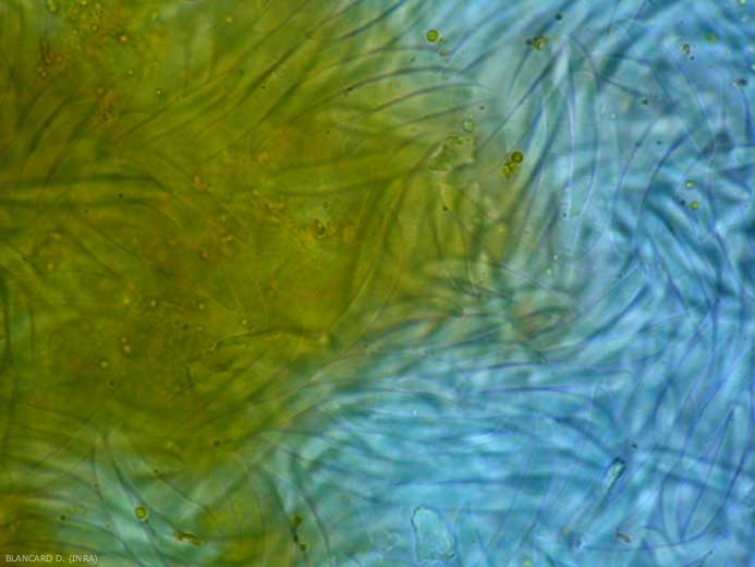 Muchos macroconidios están formados por esporodoquios (grupo de conidióforos y conidios) de <b> <i> Fusarium </i> spp.  </b> 