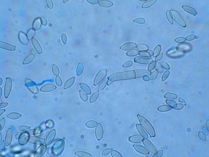 Los conidios de <i> <b> Cladosporium cucumerinum </b> </i> son oblongos, fusiformes, asépticos, rara vez de 1 a 2 septados;  luego miden 4,6-5,7 x 16,4-22,5 µm (cladosporiosis).