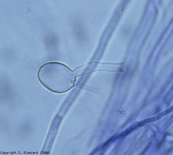 Esporangio globular y vacío de <b> <i> Pythium </i> sp. </b> que lleva un tubo de descarga.