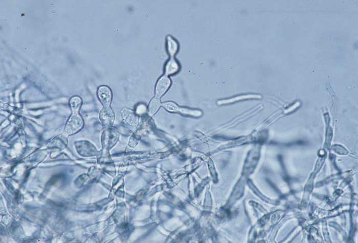 Se pueden ver artículos en forma de barril en el micelio;  se consideran esclerocios en blanco.  <b> <i> Thanatephorus cucumeris </i> </b> (<i> Rhizoctonia solani </i>, "amortiguación", "podredumbre del fondo")