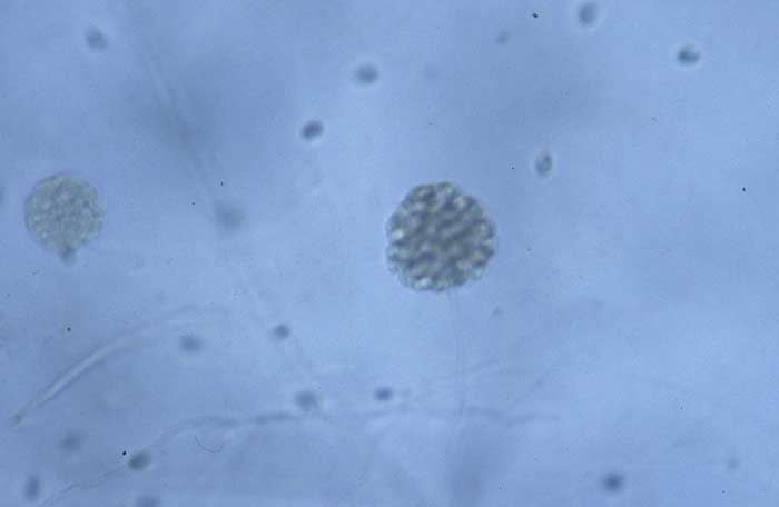 Esporangio filamentoso <b><i>Pythium</i> sp.</b> ("damping-off")