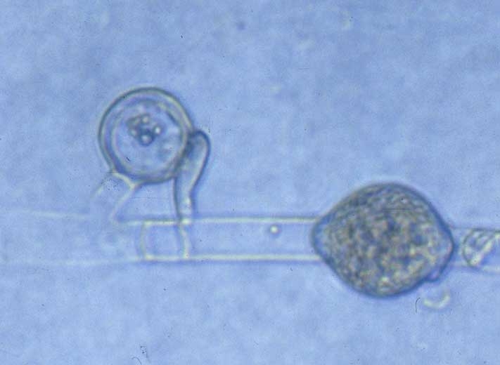 Oogonio liso fertilizado por un anteridio, hinchazón hifal intercalar. <b><i>Pythium</i> sp.</b> ("damping-off")
