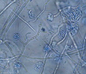 Conidióforos jóvenes de <b> <i> Fusarium oxysporum </i> f. sp. <i> lycopersici </i> </b> formando microconidios unicelulares. <b> Marchitez vascular por fusarium (<i> Fusarium </i> marchitez) </b>