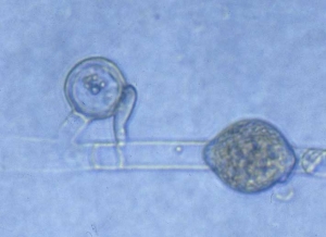 Oogonio liso fertilizado por un anteridio, hinchazón hifal intercalar. <b><i>Pythium</i> sp.</b> ("damping-off")
