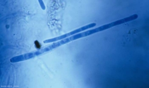 Los conidios formados al final de los conidióforos son hialinos y cilíndricos. Muestran de 1 a 18 particiones y miden de 11 a 170 µm de largo. <b> <i> Cercospora longissima </i> </b>