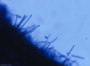 Varios conidióforos erectos y no ramificados de <b> <i> Cercospora longissima </i> </b> son visibles en la epidermis de esta hoja. Inicialmente hialinos, gradualmente se vuelven marrones.