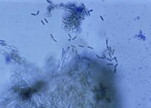 Los fialidos forman conidios cilíndricos, redondeados en sus extremos, hialinos a ligeramente oliva. <b> <i> Myrothecium roridum </i> </b> 
