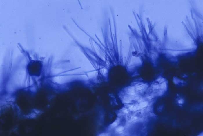 A partir des amas noirs prélevés sur les feuilles, on observe au microscope les conidies très allongées du champignon. <b><i>Cercospora nicotianae</b></i> (cercosporiose, "frog eye")
