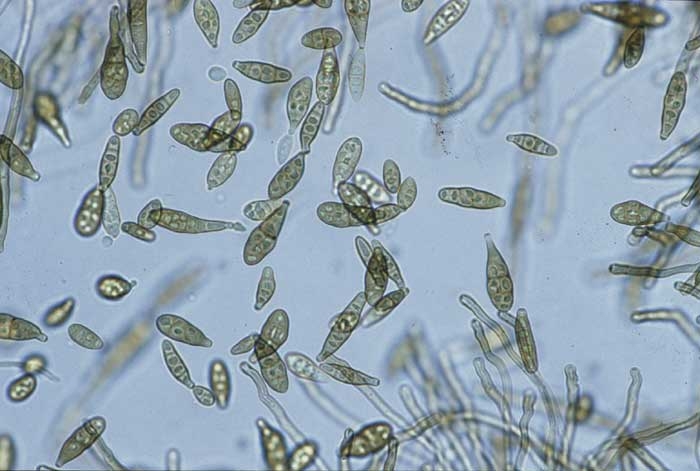 <i><b>Alternaria alternata</b></i> (brown spot) produit une multitude de conidies plus ou moins brunes, pluricellulaires, disposées en chaînes à partir de conidiophores relativement courts.