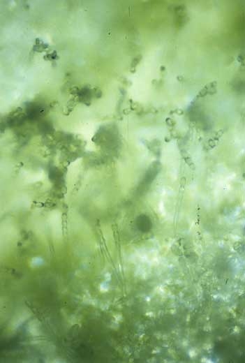 En fait, les taches sont constituées du mycélium du champignon et d'une profusion de conidiophores et de conidies formant des chaînes. <b><i>Golovinomyces cichoracearum</i> var. <i>cichoracearum</i></b> (oïdium, "powdery mildew")
