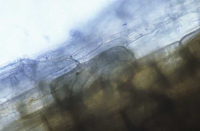 Dans le cortex de la racine des plantes malades, bien souvent on peut noter la présence d'adultes, de larves et d'oeufs de ces nématodes endomigrateurs. <i><b>Pratylenchus</i> spp.</b> (lesion nematodes)
