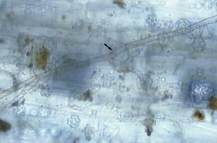 Le mycélium brun et ramifié de <b><i>Rhizoctonia solani </i></b>est aisément visible sur ce système racinaire. 