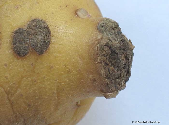 Tumeur en relief "en tétine" sur tubercules, observée dans certains cas de forte attaque de gale poudreuse (<i><b>Spongospora subterranea</i></b>)
