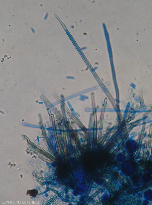 Détail d'une jeune conidie se formant à l'extrémité d'un conidiophore mélanisé. Notez la présence de quelques cloisons transversales à la base de la spore. <i>Cercospora longissima</i> (cercosporiose)