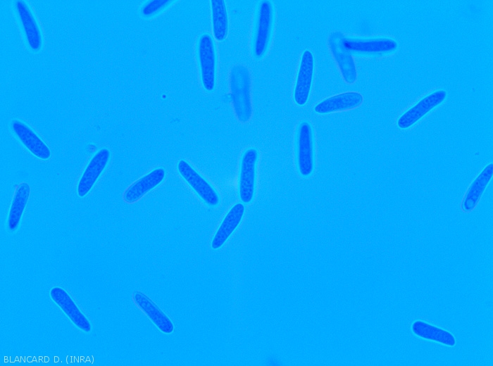 Détail de conidies de <i><b>Colletotrichum</i> sp.</b> cylindriques. (anthracnose)