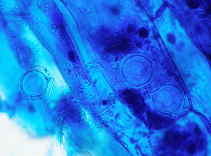 Aspect d'oospores de <b><i>Pythium</i> sp.</b> observées au microscope photonique. (Oomycètes)
