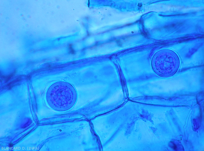 Aspect d'oospores de <b><i>Pythium</i> sp.</b> observées au microscope photonique. (Oomycètes)