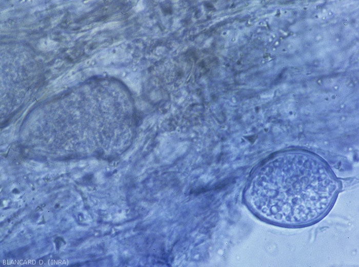 Deux sporanges d'un <i>Phytophthora</i> sp. sont visibles dans les tissus altérés. (Oomycètes)
