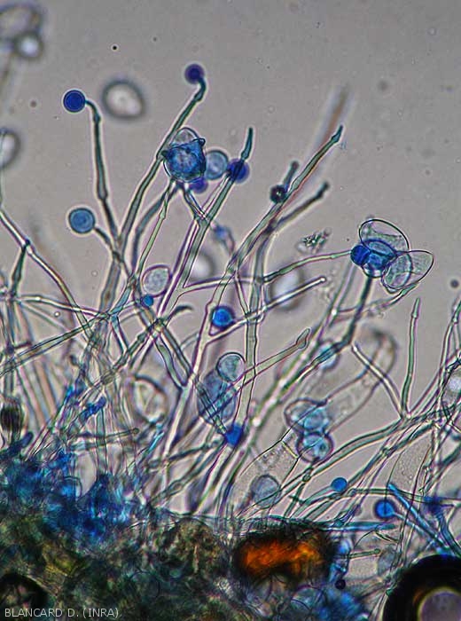 Plusieurs jeunes sporangiophores pourvus de renflements sont en train de se développer. (<i>Phytophthora infestans</i>) (mildiou)