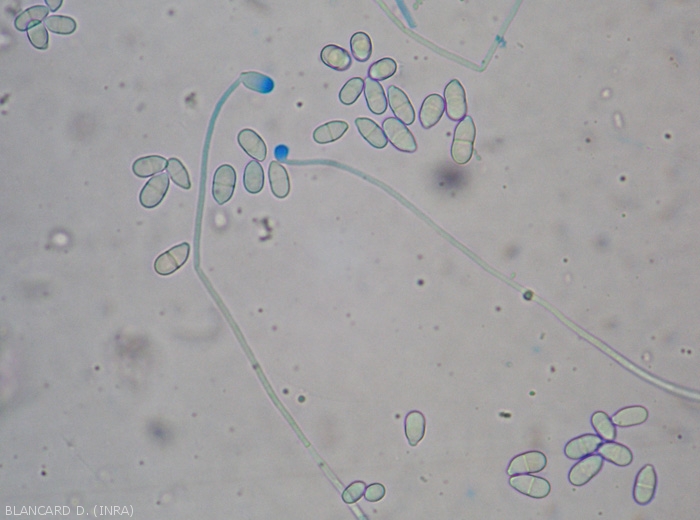 Aspect au microscope photonique de conidiophores et de conidies de  <i><b>Trichothecium roseum</b></i>. (moisissure rose)