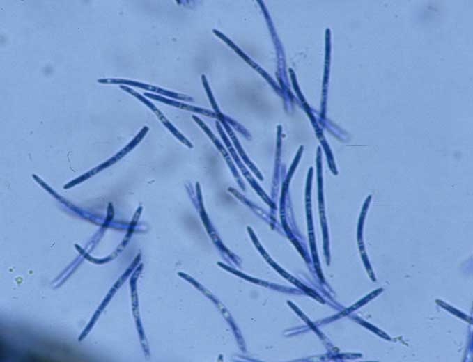 Les conidies produites par les pycnides de <b><i>Septoria lactucae</i></b> (septoriose, "<i>Septoria</i> leaf spot") sont hyalines et filiformes ; elles montrent de 1 à 3 cloisons. Leurs dimensions sont variables : 25-40 x 1,5-2 µm.
