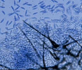 Aspect des conidies produites par des acervules de <i></b>Colletotrichum orbiculare</b></i> (nuile rouge ou anthracnose)