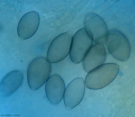 Plusieurs sporanges plus ou moins mélanisés sont visibles sur ce limbe observé au microscope photonique. <i><b>Pseudoperonospora cubensis</b></i>  (mildiou)