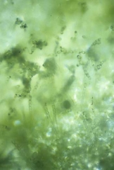 En fait, les taches sont constituées du mycélium du champignon et d'une profusion de conidiophores et de conidies formant des chaînes. <b><i>Golovinomyces cichoracearum</i> var. <i>cichoracearum</i></b> (oïdium, "powdery mildew")
